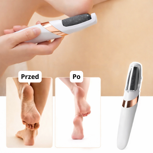 SoftSteps - Elektryczny pilnik do stóp i pięt